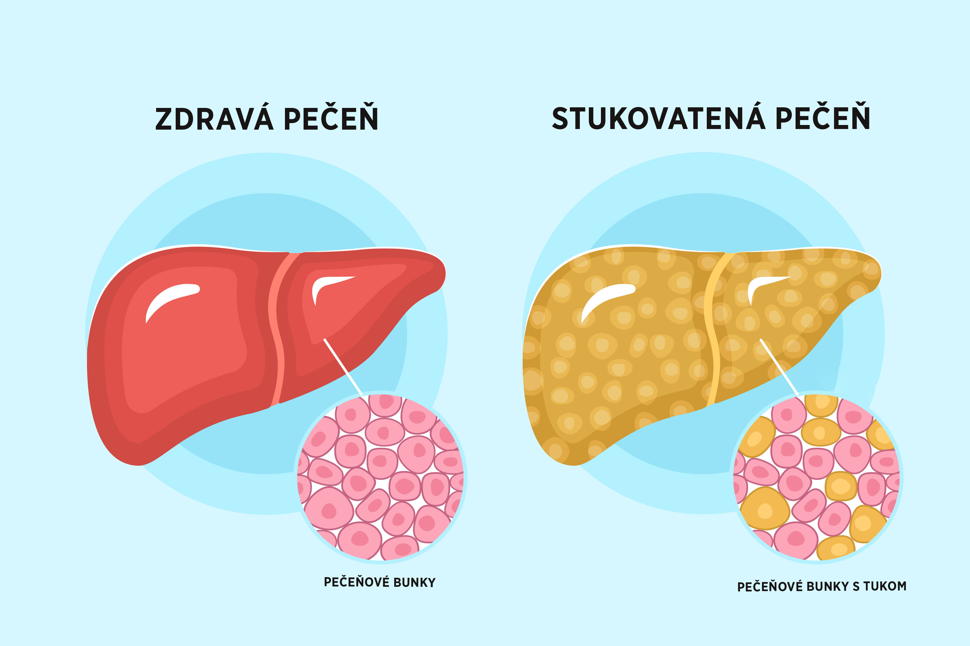 pečeňová dieta